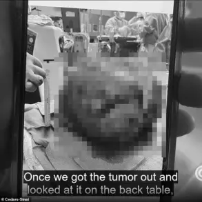 Young Patient's Miraculous Survival: Ariana Pulido's Battle Against a Life-Threatening Tumor and the Medical Innovations That Saved Her