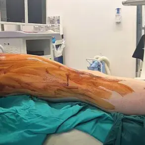 A Painful Path to Perfection: The Grueling Reality of Height-Enhancing Surgery in the UK