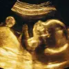 AI Revolutionizes Due Date Prediction with 95% Accuracy, Challenging Naegele's Rule