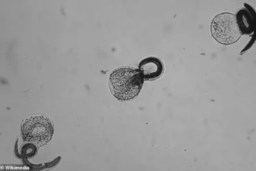 CDC Issues Public Health Alert: Avoid Wild Animal Contact After Raccoon Roundworm Infections in California Children