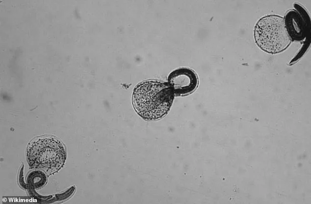 CDC Issues Public Health Alert: Avoid Wild Animal Contact After Raccoon Roundworm Infections in California Children