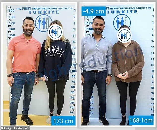Controversial Height-Reduction Surgery Sparks Debate in Istanbul
