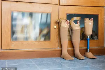 Innovative Surgery Saves Foot and Enables Walking Rugby After Blister