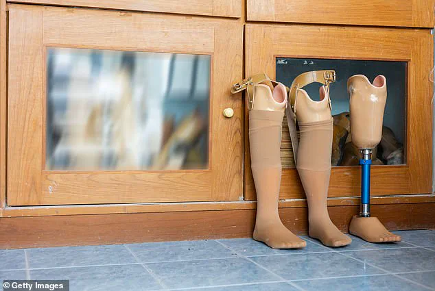 Innovative Surgery Saves Foot and Enables Walking Rugby After Blister