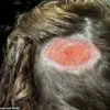 North Carolina Teen Suffers Scalp Burn After Hair Dye Mishap