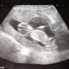 Rare Cancer Diagnosis During Pregnancy: A Mother's Unforeseen Journey