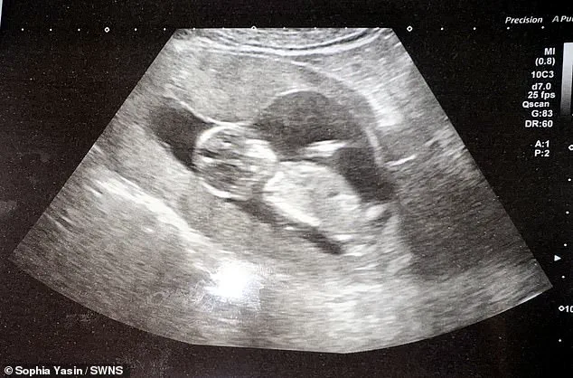 Rare Cancer Diagnosis During Pregnancy: A Mother's Unforeseen Journey
