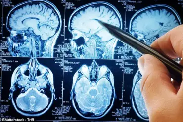 Study Suggests Link Between Traumatic Brain Injuries and Increased Risk of Brain Tumors