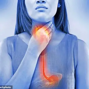 Understanding Acid Reflux: Symptoms, Prevalence, and Impact on Daily Life