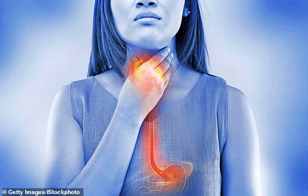 Understanding Acid Reflux: Symptoms, Prevalence, and Impact on Daily Life