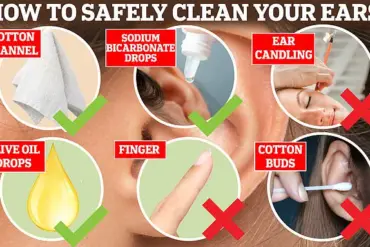Excessive Earwax Buildup Revealed as Cause of 10-Year Tinnitus Battle