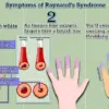 Experts Hail Potential Cure for Raynaud's Disease, Affecting Up to 30 Million Americans