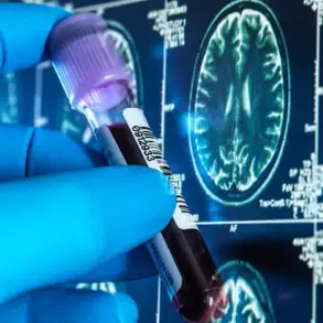 NHS Trial of Alzheimer's Blood Tests Could Transform Dementia Diagnosis