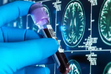 NHS Trial of Alzheimer's Blood Tests Could Transform Dementia Diagnosis
