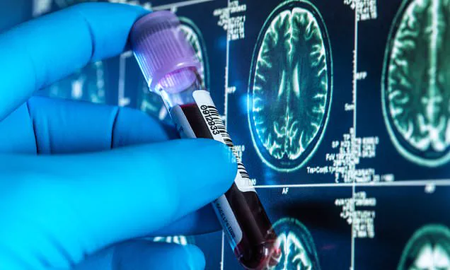 NHS Trial of Alzheimer's Blood Tests Could Transform Dementia Diagnosis