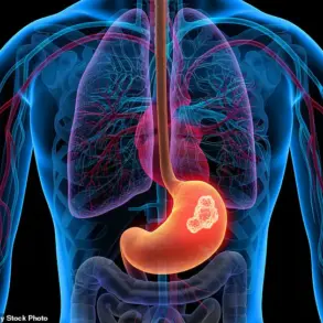 Undetected Oesophageal Cancer in A&E: The Consequences of Delayed Diagnosis